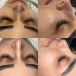 خدمات تخصصی پاکسازی پوست ساجده عنایتی