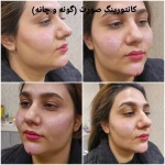 کلینیک زیبایی و لیزر مو گندم