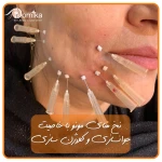 مرکز زیبایی درنیکا