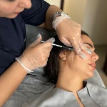 نمونه کار مرکز پوست مو و لیزر گوزل