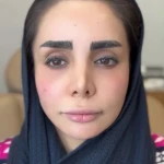 مرکز لیزر و کلینیک زیبایی الیسو