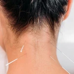 مرکز لیزرو پوست و طب سوزنی الماس تابان