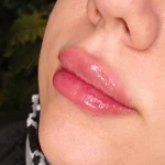 نمونه کار مرکز لیزر ونوس طلایی