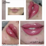 لوگوی مطب زیبایی zh one دکتر زینب هاشمی