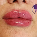 مطب زیبایی دکتر مینو شعبانی