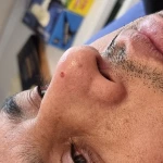 پاکسازی پوست(فیشال) و خدمات مو مرجان آرا