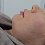 کلینیک زیبایی و لیزر مو  گندم