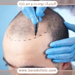 نمونه کار کلینیک پوست مو و زیبایی و کاشت مو باراد