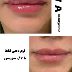 کلنیک پوست مو زیبای لیزر هیوا