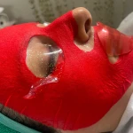 فیشیال پوست با سحر