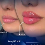 کلینیک زیبایی molaye