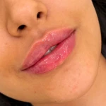 مطب پوست،مو ، زیبایی ولیزر