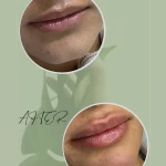تصویر کلینیک زیبایی لاغری لیزر دانا