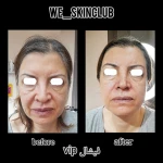 خدمات فیشال دیاموند وی کلاب