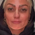 کلینیک زیبایی پوست و لیزر بلاریا