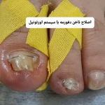 پدیکور و پودولوژیSD