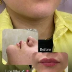 نمونه کار کلینیک زیبایی دکتر امجدیان