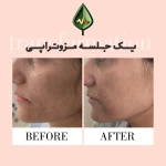 کلینیک زیبایی و مرکز لیزر آیه نقی زاده