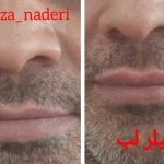  مرکز زیبایی و لیزر دکتر رضا نادری