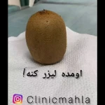 مرکز لیزر و کلینیک زیبایی مهلا