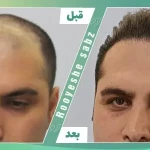 تصویر کلینیک تخصصی کاشت مو و ابرو رویش سبز