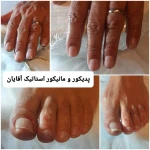 پدیکور و پودولوژیSD