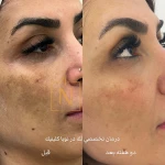 كلينيك تخصصي پوست و ليزر نوبا