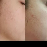 کلینیک تخصصی پوست و مو بهاره محمدحسینی