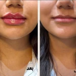 تصویر کلینیک زیبایی و لیزر مو گندم