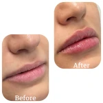 نمونه کار مرکز زیبایی و لیزر دکتر صباغی
