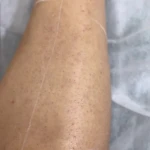 تصویر کلینیک پاکسازی پوست و لیزرکندلا رها