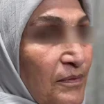 نمونه کار کلینیک زیبایی پوست و لیزر بلاریا