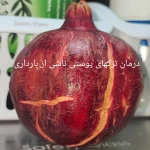 کلینیک زیبایی پوست و لیزر ایده آل