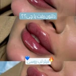 کلینیک پوست و مووزیبایی دالیا