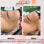 مرکز تخصصی الکترولیز زیبی