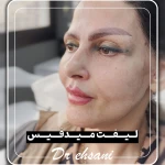 نمونه کار کلینیک جراحی زیبایی دکتر محمدحسین احسانی