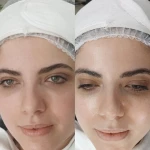 مرکز لیزر موهای زائد و پاکسازی پوست نوترسا