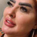 مطب پوست،مو ، زیبایی ولیزر