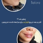 کلینیک زیبایی و مرکز لیزر ماری اسکین