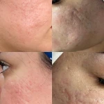  کلینیک زیبایی ژاله