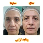 خدمات فیشال دیاموند وی کلاب