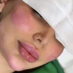 نمونه کار کلینیک زیبایی الماس