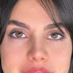 کلینیک زیبایی و لیزر لوسیفر