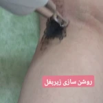 کیلینک پوست مو و لیزر نورا