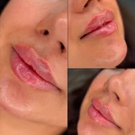 نمونه کار کلینیک پوست مو زیبایی زیما