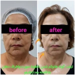 تصویر کلینیک زیبایی دکتر کاشانی