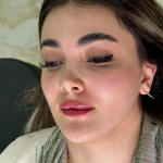 کلینیک تخصصی پوست مو و زیبایی شاداب