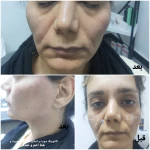 کلینیک زیبایی و لیزر مو گندم