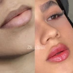 کلینیک لیزر پوست و مو زیبایی توکا