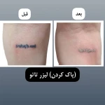  کلینیک لیزر و زیبایی راشا